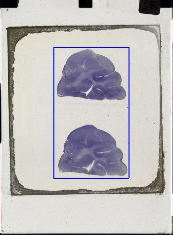Media type: image; Special Collections 3043   shows specimen_part histological serial section;